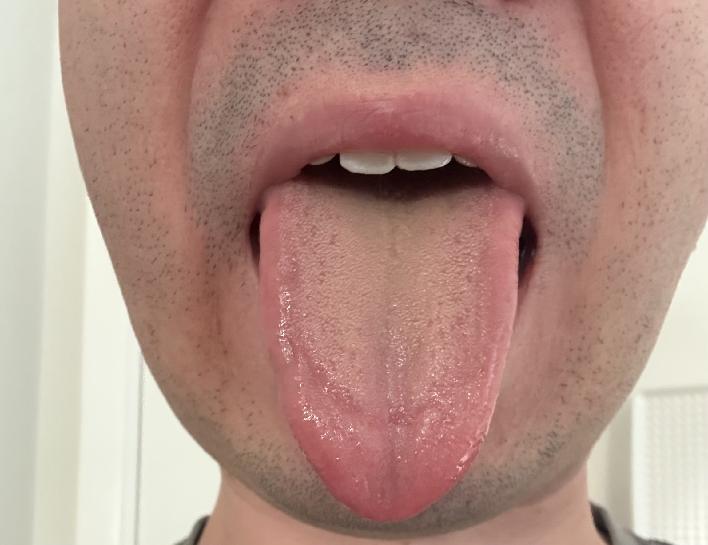 Demo tongue image